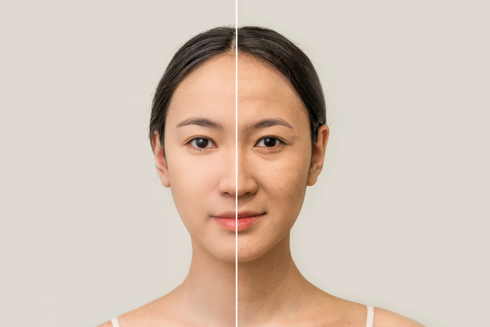 Dr. Celine Leong’s Anti Ageing Tips for Women in their 20s, 30s and 40s